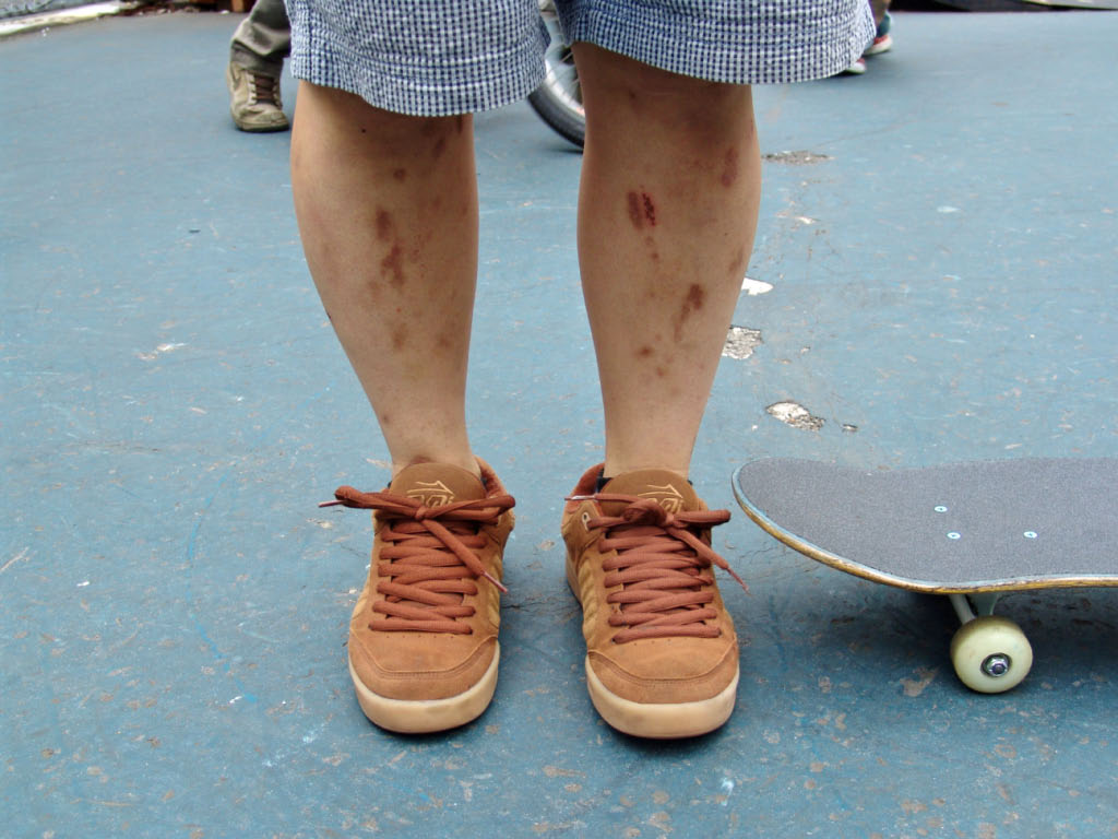 Tokyo: skater legs